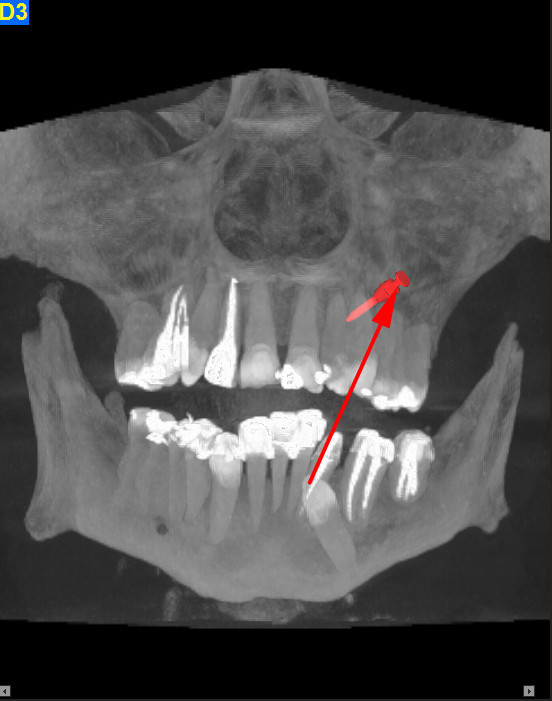 Ortodontie 3D (FILEminimizer)